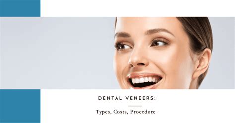 Veneers: Cost, Procedure, and What to Expect .